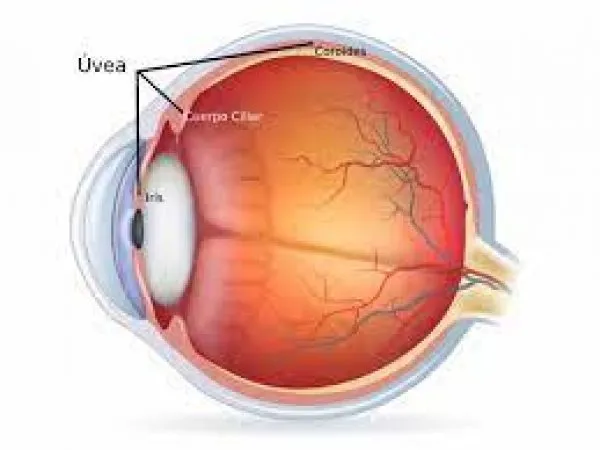 Uveitis Treatment